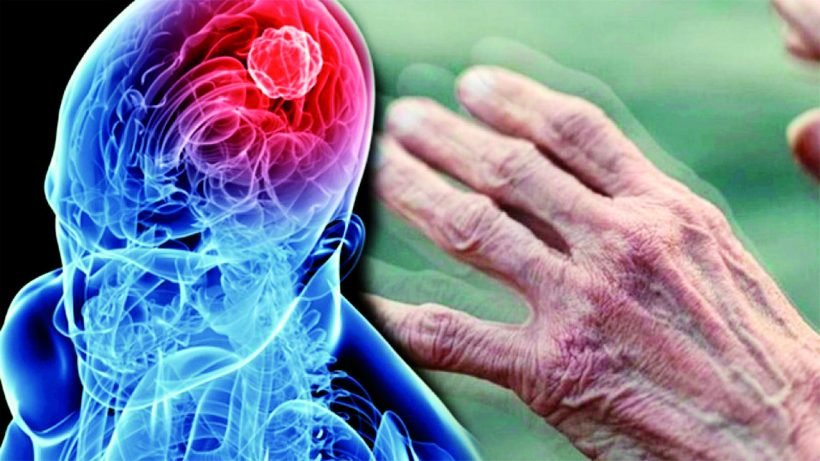 Genetic Breakthrough: A Revolution in Reshaping Parkinson's Treatment 1 Genetic Breakthrough: A Revolution in Reshaping Parkinson's Treatment