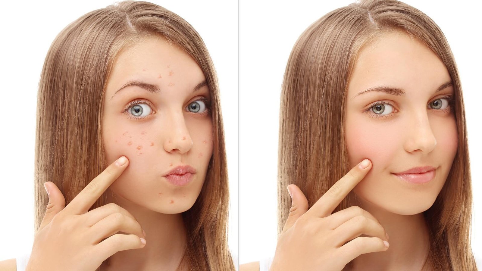 What Causes Dark Spots and How to Treat Them 10 What Causes Dark Spots and How to Treat Them