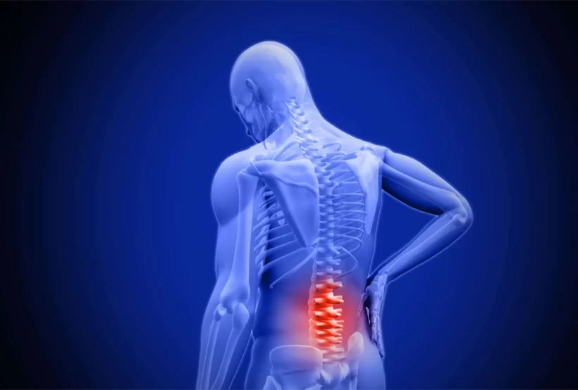 Understanding Lower Back Pain: Causes and Remedies