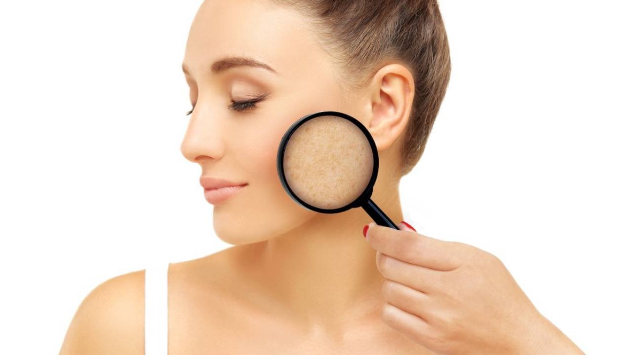 What Causes Dark Spots and How to Treat Them 11 What Causes Dark Spots and How to Treat Them