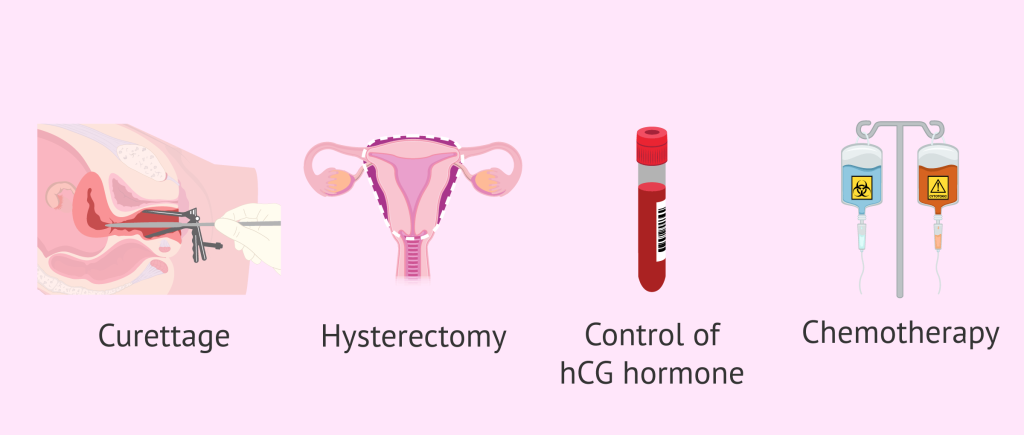 Shocking information on Cervical Cancer: To Prevent and Treat 13 Shocking information on Cervical Cancer: To Prevent and Treat