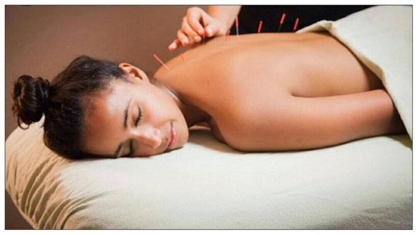 Acupuncture: A Thing for the Healthy Person?