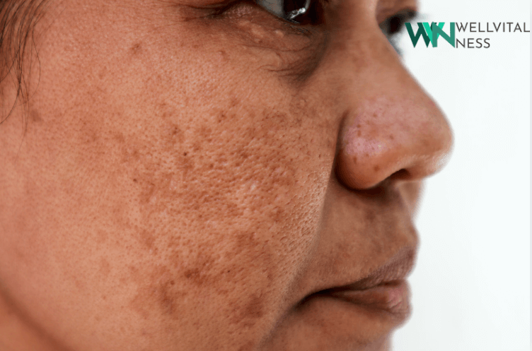 Comprehensive Guide to Skin Diseases: Causes, Symptoms, Diagnosis, and Advanced Treatments 1 Skin Diseases